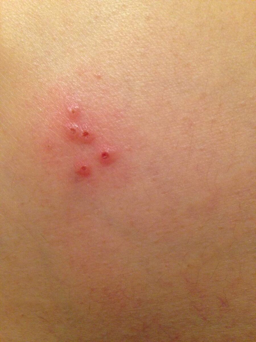 Exterminateur pour puces