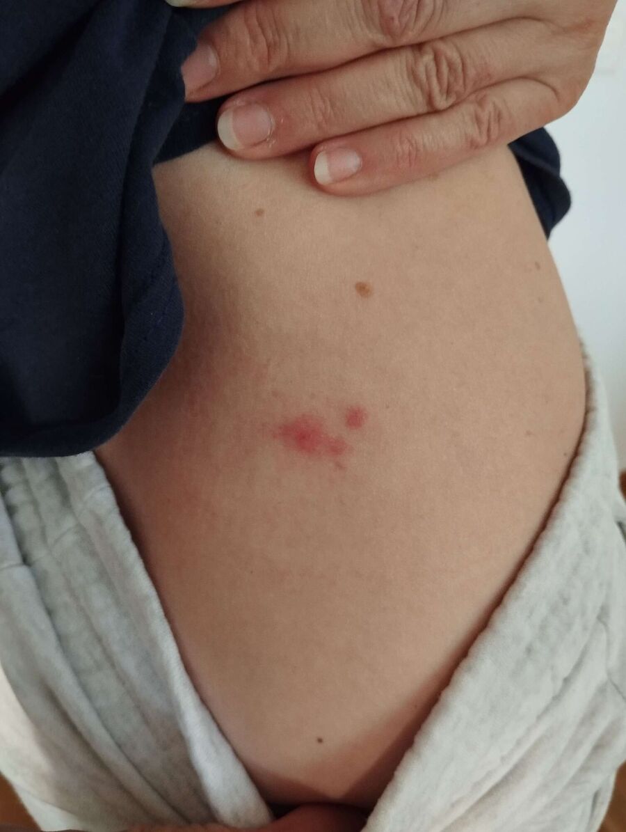 desinfestateur a-La Sonnaz-Inspektion.jpeg