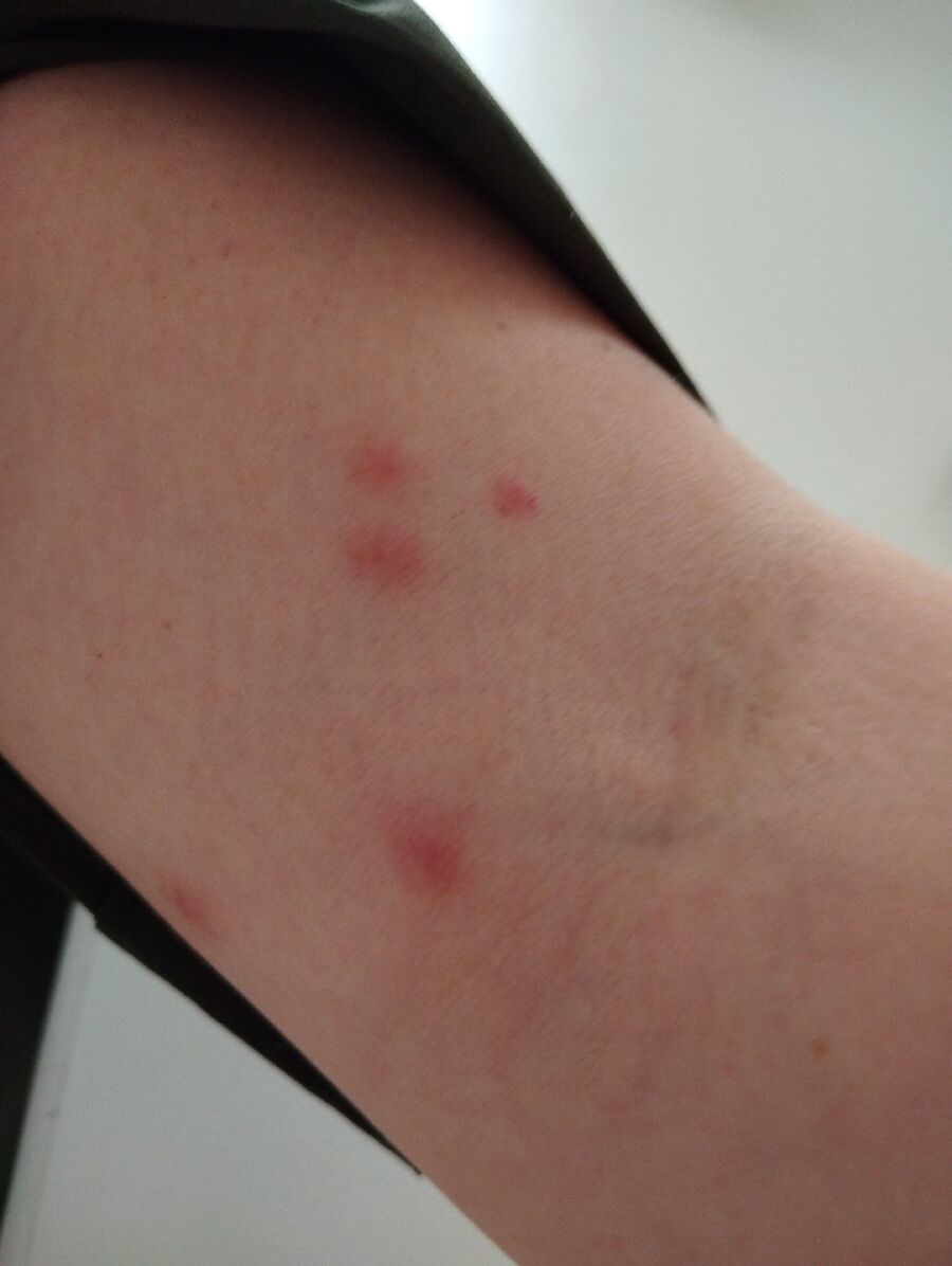 desinfestateur a-Basse-Allaine-Inspektion.jpeg